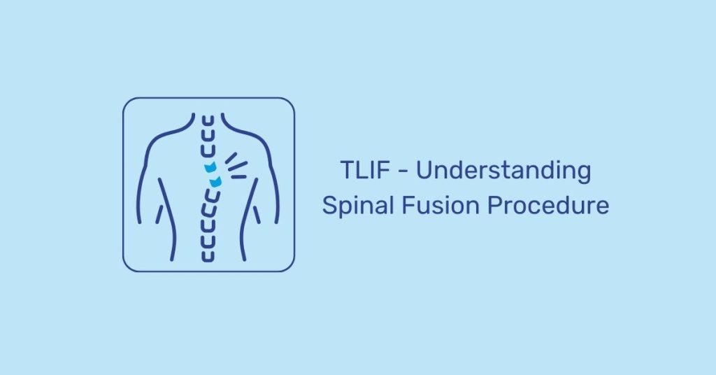 Understanding Transforaminal Lumbar Interbody Fusion (TLIF) Procedure